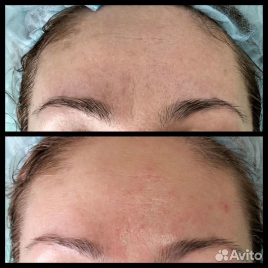 Услуги косметолога