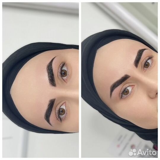 Бровист
