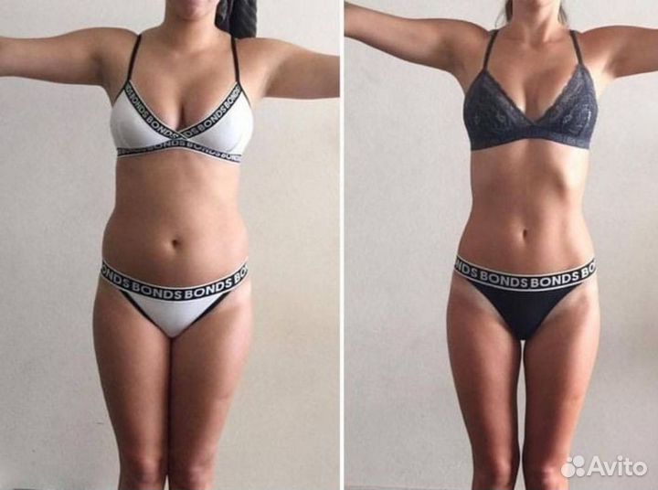 Массаж для коррекции фигуры/Тейпирование