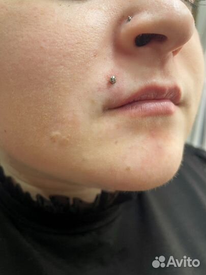 Прокол ушей