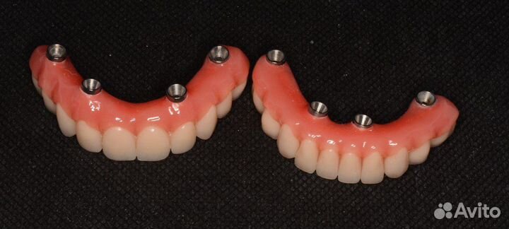 Зубной техник All-on-4