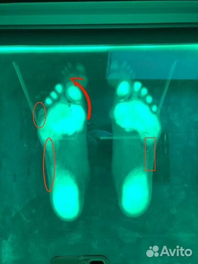 Инструктор лфк (вальгус, плоскостопие, сутулость)