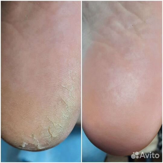 Комбинированный маникюр