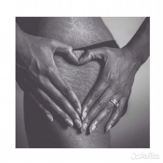 Камуфляж растяжек/рубцов