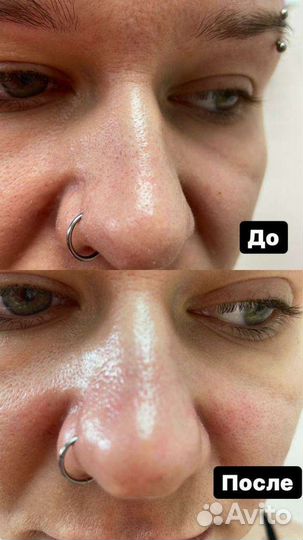 Нанесение маски по типу кожи