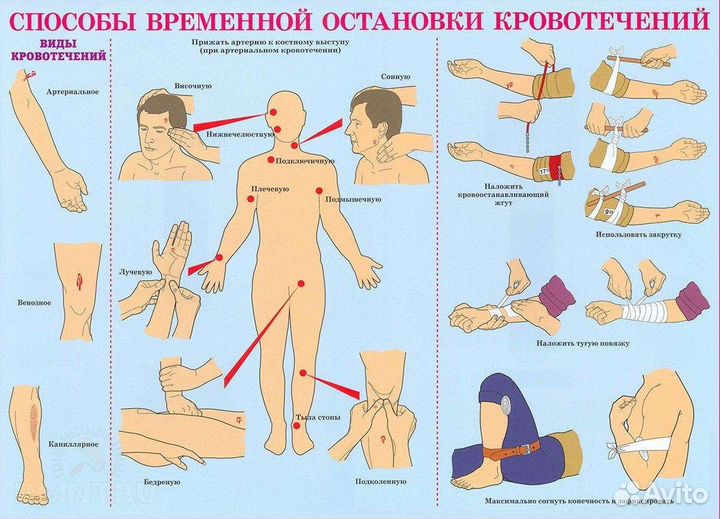 Бинт Кровоостанавливащий. Лента (Жгут) Резиновая