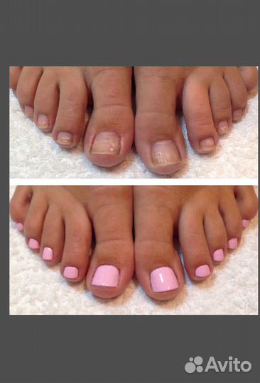 Маникюр, наращивание, педикюр, подолог