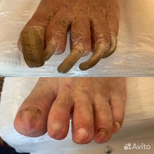 Подолог педикюр маникюр