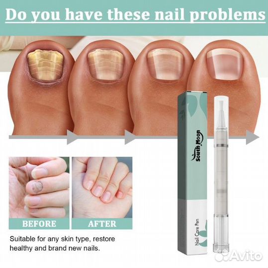 Противогрибковый карандаш для ногтей, 4 мл