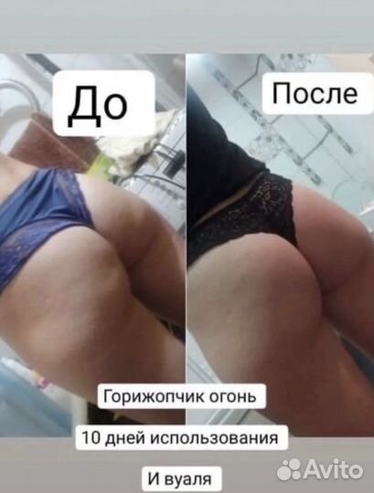 Антицеллюлитный гель nl