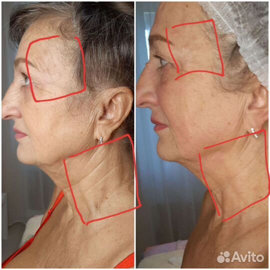 Массаж лица и тела