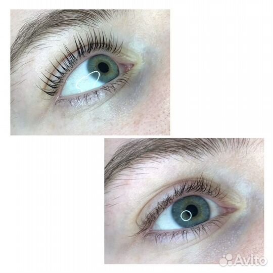 Стрейчинг ресниц