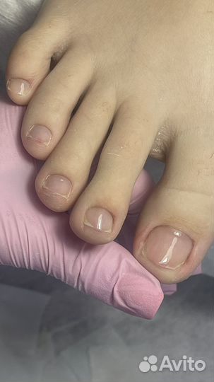 Услуги подолога