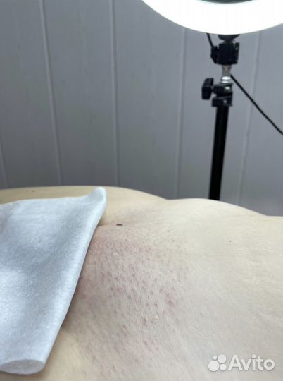 Шугаринг депиляция