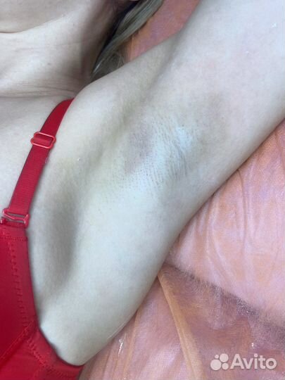 Депиляция воском