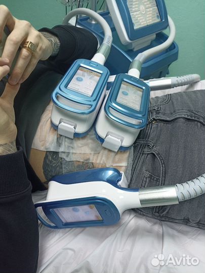 Криолиполиз