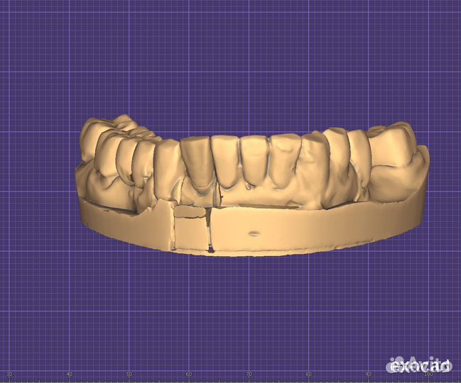 Моделирование в exocad зубной техник CAD CAM