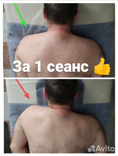 Костоправ, Мануальный массаж, Массажист