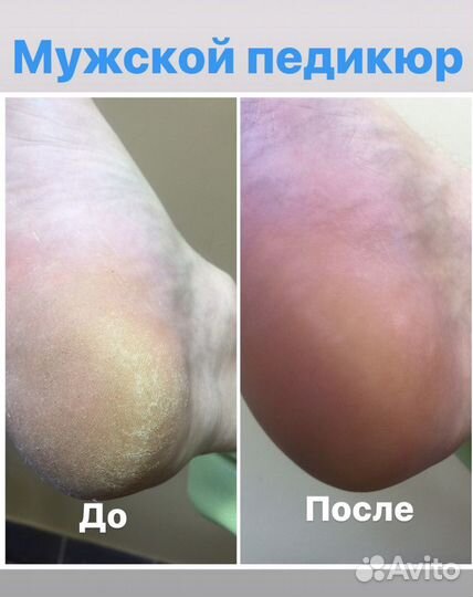 Маникюр, педикюр