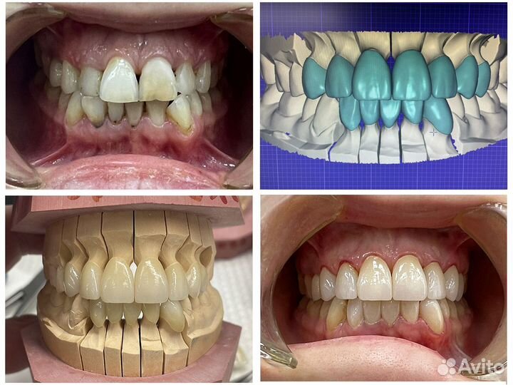 Зубной техник керамист