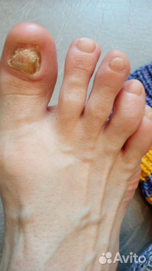 Аппаратный маникюр