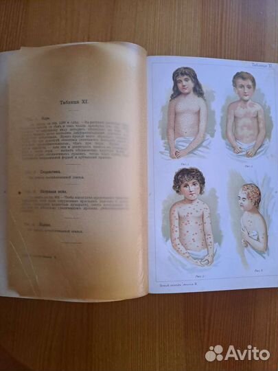 Старинная книга.Новый способ лечения. Платен