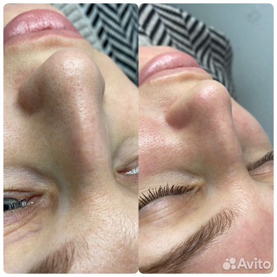 Услуги косметолога