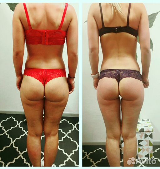 Lpg массаж,прессомассаж, антицеллюлитные комплексы