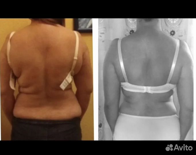 Выравнивание тела