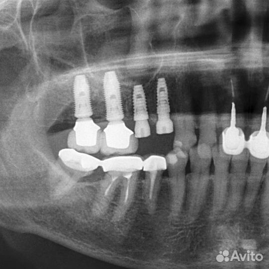 Хирург имплантолог
