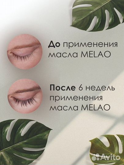 Инфографика для маркетплейсов, продающий дизайн