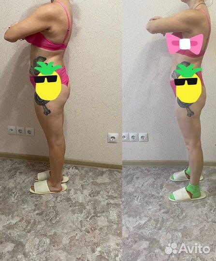 Антицеллюлитный массаж, кавитация, RF, массаж ШВЗ