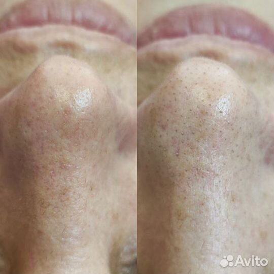 Обучение косметик-эстетист