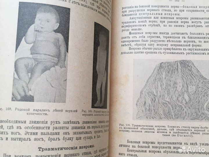 Хирургическая невропатология 1917.Пуссеп