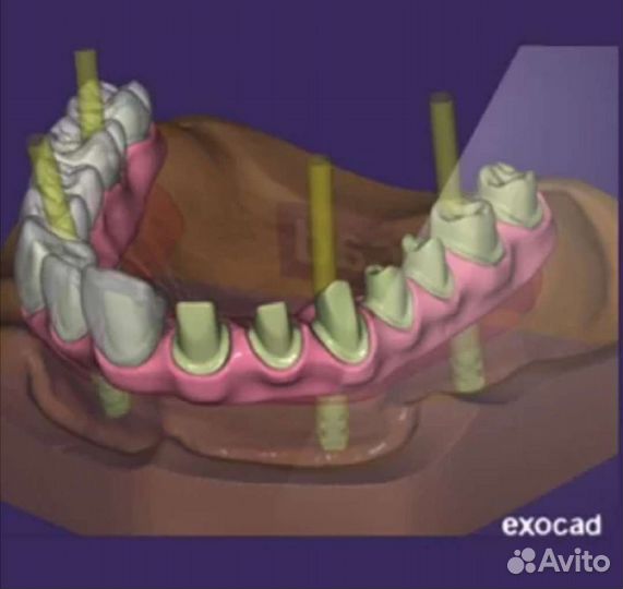 Зубной техник
