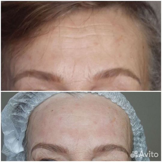 Массаж лица и тела