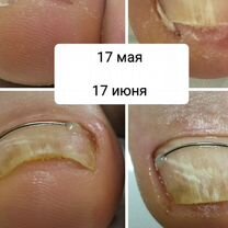 Подолог. Выезд на дом, Казань
