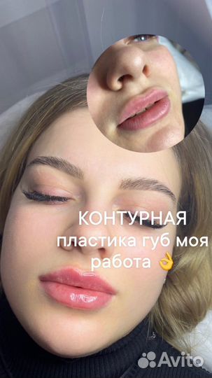Услуги косметолага