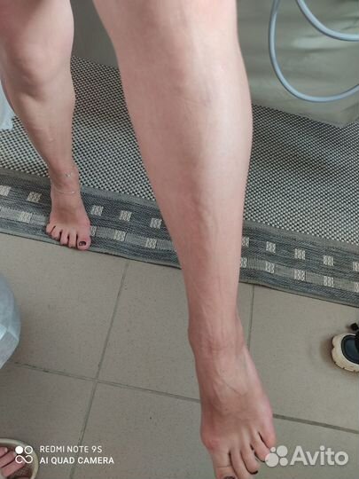 Прессотерапия от отёков Казачья бухта Севастополь