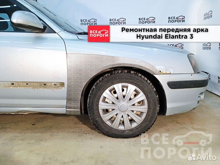 Рем арки для Хендай Элантра III (XD2)
