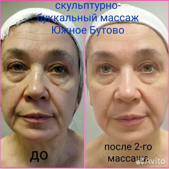 Массажист-косметолог Южное Бутово (за 2 часа-2000)
