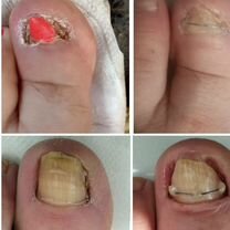 Подолог. Выезд на дом, Казань