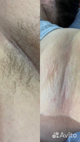 Мастер шугаринга