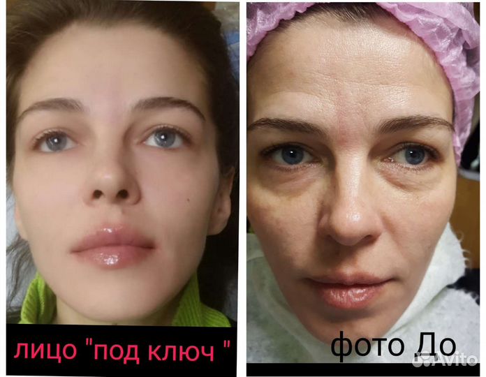 Услуги косметолога
