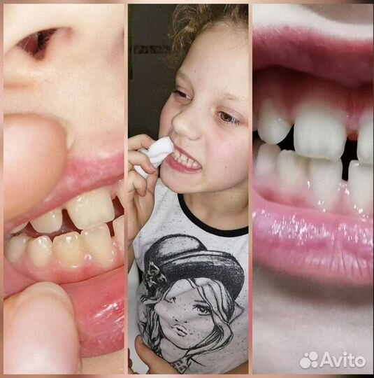 Спонж для зубов