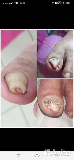 Подолог с опытом работы