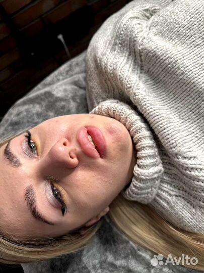 Увеличение губ