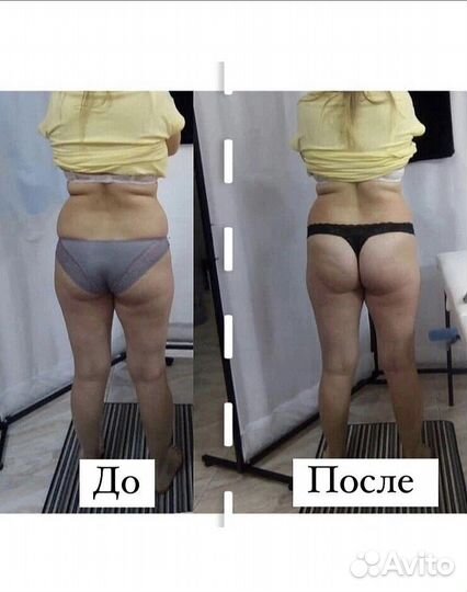Вакуумный массаж + 4 процедуры для похудения
