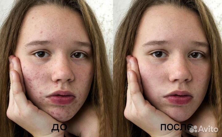 Услуги фотошопа