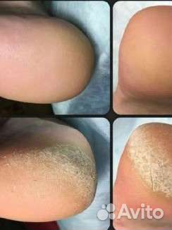 Подолог эстэтист